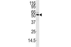 Western blot analysis of CAMKK1 antibody and mouse thymus tissue lysate. (CAMKK1 Antikörper  (AA 337-369))