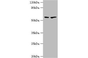 Western blot All lanes: 5-aminolevulinate synthase, erythroid-specific, mitochondrial antibody at 7 μg/mL Lane 1: 293T whole cell lysate Lane 2: Mouse brain tissue Secondary Goat polyclonal to rabbit IgG at 1/10000 dilution Predicted band size: 65, 61, 50, 64 kDa Observed band size: 65 kDa (ALAS2 Antikörper  (AA 50-320))
