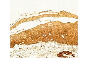 ABIN6261408 and ABIN6266511 at 1/100 staining Human normal tissues adjacent to esophageal cancer by IHC-P.