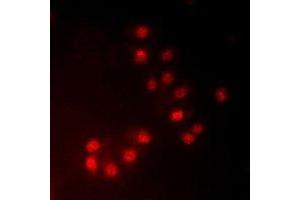 Immunofluorescent analysis of MKI67IP (pT234) staining in HeLa cells. (NIFK Antikörper  (pSer234))