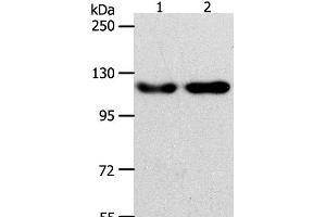 Western Blot analysis of Hela and Jurkat cell using ABL2 Polyclonal Antibody at dilution of 1:400 (ABL2 Antikörper)