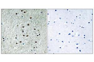 Immunohistochemistry analysis of paraffin-embedded human brain tissue using REXO1 antibody. (REXO1 Antikörper  (Internal Region))