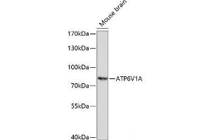 Western blot analysis of extracts of Mouse brain using ATP6V1A Polyclonal Antibody at dilution of 1:1000. (ATP6V1A Antikörper)
