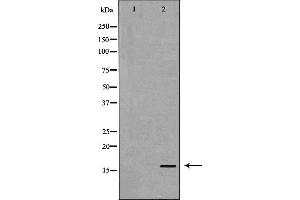 Western blot analysis of Blood  lysate using TTR antibody.