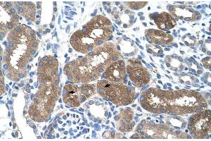 Immunohistochemistry (IHC) image for anti-Suppressor of Cytokine Signaling 1 (SOCS1) (N-Term) antibody (ABIN2777164)