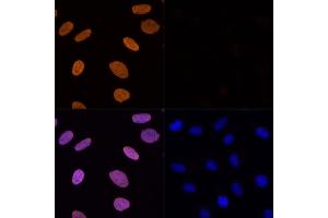 Immunofluorescence analysis of U-2 OS cells using Acetyl-Histone H3-K56 Rabbit pAb (ABIN7267674) at dilution of 100 (40x lens).