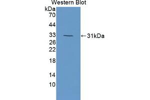 Western blot analysis of the recombinant protein. (DOK7 Antikörper  (AA 63-320))