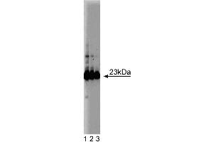 Western blot analysis of GST-pi on a HeLa cell lysate (Human cervical epitheloid carcinoma, ATCC CCL-2. (GSTP1 Antikörper  (AA 5-210))
