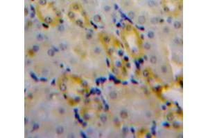 Used in DAB staining on fromalin fixed paraffin-embedded Kidney tissue (CLIC4 Antikörper  (AA 104-253))