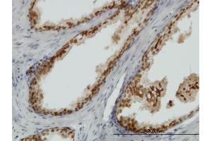 Immunoperoxidase of monoclonal antibody to FOXA1 on formalin-fixed paraffin-embedded human prostate. (FOXA1 Antikörper  (AA 367-472))