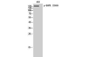 Western Blotting (WB) image for anti-Epidermal Growth Factor Receptor (EGFR) (pTyr869) antibody (ABIN3179433) (EGFR Antikörper  (pTyr869))