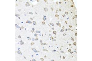 Immunohistochemistry of paraffin-embedded mouse brain using APCS antibody (ABIN5971040) at dilution of 1/100 (40x lens).