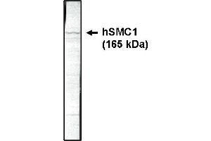Western blotting using SMC1 antibody on HeLa cell lysate at 1 µg/ml. (SMC1A Antikörper  (AA 402-894))