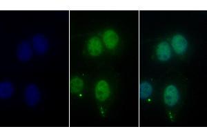 Detection of HDAC1 in Human Hela cell using Monoclonal Antibody to Histone Deacetylase 1 (HDAC1) (HDAC1 Antikörper  (AA 1-482))