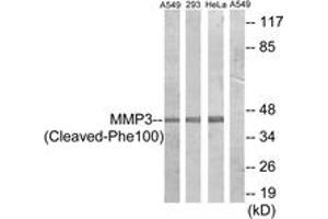 Western blot analysis of extracts from A549/293/HeLa cells, treated with etoposide 25uM 24h, using MMP3 (Cleaved-Phe100) Antibody. (MMP3 Antikörper  (Cleaved-Phe100))