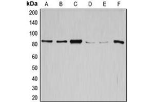 Western blot analysis of GYS1 expression in SW626 (A), SKOV3 (B), HeLa (C), K562 (D), HepG2 (E), mouse liver (F) whole cell lysates. (Glycogen Synthase 1 Antikörper  (C-Term))