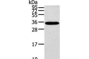 Western Blot analysis of Mouse brain tissue using KCNMB3 Polyclonal Antibody at dilution of 1:300 (KCNMB3 Antikörper)