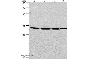 Western blot analysis of A549, 231, PC3 and hela cell, using MAD2L1BP Polyclonal Antibody at dilution of 1:675 (MAD2L1BP Antikörper)