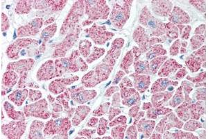 anti-Isocitrate Dehydrogenase (IDH) antibody