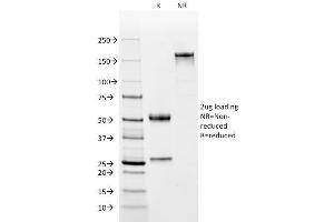 SDS-PAGE Analysis Purified Complement 4d Mouse Monoclonal Antibody (C4D204). (C4A Antikörper  (CF®488A))