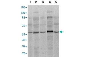 Western blot analysis of SMAD4 monoclonal antobody, clone 4G1C6  against A-431 (1), SK-N-SH (2), K-562 (3), HepG2 (4) and HUVE12 (5) cell lysate. (SMAD4 Antikörper)