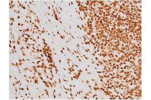 ABIN6267604 at 1/200 staining Human tonsil tissue sections by IHC-P. (c-Rel Antikörper  (pSer503))