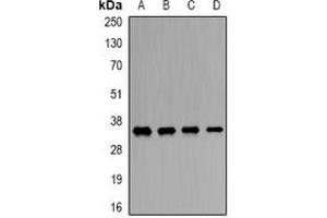 Western blot analysis of ORC6 expression in SW620 (A), Hela (B), mouse liver (C), rat brain (D) whole cell lysates.