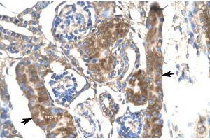 Human kidney; SLC17A2 antibody - middle region in Human kidney cells using Immunohistochemistry (SLC17A2 Antikörper  (Middle Region))