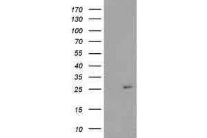 Western Blotting (WB) image for anti-Cyclin-Dependent Kinase Inhibitor 3 (CDKN3) antibody (ABIN1497457) (CDKN3 Antikörper)