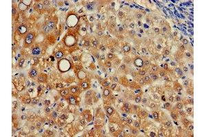 Immunohistochemistry (IHC) image for anti-Integral Membrane Protein 2A (ITM2A) (AA 79-263) antibody (ABIN7156381)
