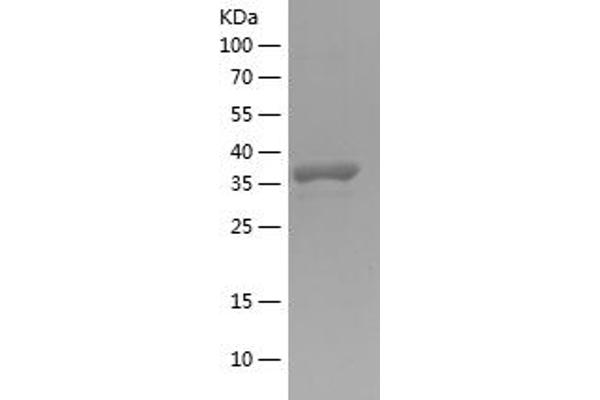 ANGPTL2 Protein (AA 23-135) (His-IF2DI Tag)