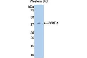 Western blot analysis of the recombinant protein. (KRT15 Antikörper  (AA 105-411))