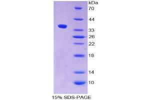 SDS-PAGE (SDS) image for Alkaline Phosphatase, Placental-Like 2 (ALPPL2) (AA 20-333) protein (His tag) (ABIN1078765)