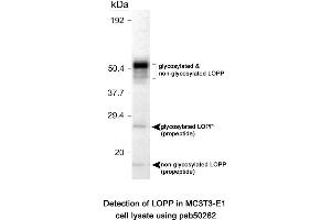 Image no. 1 for anti-Lysyl Oxidase Pro-Peptide (LOPP) (AA 78-115), (Internal Region) antibody (ABIN363571) (LOPP Antikörper  (Internal Region))