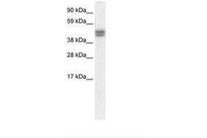 Image no. 1 for anti-SAP30 Binding Protein (SAP30BP) (AA 35-84) antibody (ABIN6736065) (SAP30BP Antikörper  (AA 35-84))