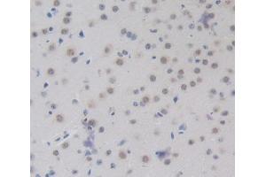 Used in DAB staining on fromalin fixed paraffin- embedded brain tissue (CEBPD Antikörper  (AA 51-251))