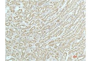Immunohistochemical analysis of paraffin-embedded Human Kidney Tissue using a-actinin Mouse mAb diluted at 1:200. (ACTN1 Antikörper)