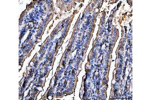 IHC analysis of CD13/Anpep using anti-CD13/Anpep antibody (ABIN7602222). (CD13 Antikörper  (AA 642-965))