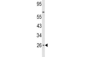 Western blot analysis of IFNB1 antibody and HepG2 lysate. (IFNB1 Antikörper  (AA 39-66))