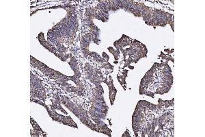 IHC analysis of MUC2 using anti-MUC2 antibody (ABIN7600606).