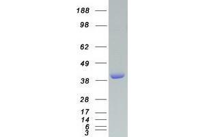 Western Blotting (WB) image for Vasodilator-Stimulated phosphoprotein (VASP) protein (Myc-DYKDDDDK Tag) (ABIN2735193)