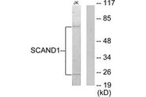 Western Blotting (WB) image for anti-SCAN Domain Containing 1 (SCAND1) (AA 61-110) antibody (ABIN2889527) (SCAND1 Antikörper  (AA 61-110))
