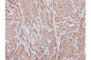 Immunohistochemistry (IHC) image for anti-ADAM Metallopeptidase with thrombospondin Type 1 Motif, 5 (ADAMTS5) (C-Term) antibody (ABIN2854716)