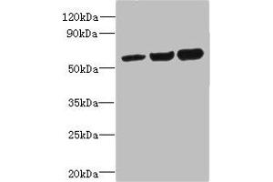 Western blot All lanes: OSBPL2 antibody at 1 μg/mL Lane 1: HepG2 whole cell lysate Lane 2: Mouse heart tissue Lane 3: Hela whole cell lysate Secondary Goat polyclonal to rabbit IgG at 1/10000 dilution Predicted band size: 56, 54 kDa Observed band size: 56 kDa (OSBPL2 Antikörper  (AA 251-480))