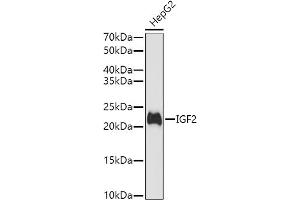 Western blot analysis of extracts of HepG2 cells, using IGF2 antibody (ABIN3022872, ABIN3022873, ABIN3022874 and ABIN6219274) at 1:1000 dilution. (IGF2 Antikörper  (AA 25-180))