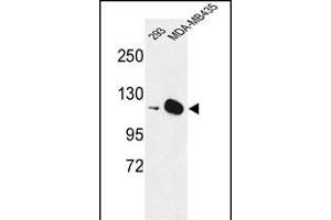 Western blot analysis of DIH2 Antibody (Center) 9407c in 293, MDA-M cell line lysates (35 μg/lane). (DIAPH2 Antikörper  (AA 870-899))