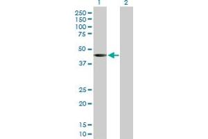 Western Blot analysis of SGK2 expression in transfected 293T cell line by SGK2 MaxPab rabbit polyclonal antibody. (SGK2 Antikörper  (AA 1-367))