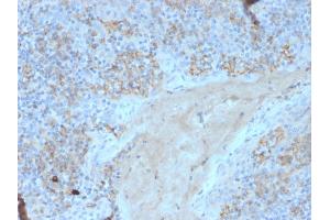 Formalin-fixed, paraffin-embedded human tonsil stained with CD95 Mouse Monoclonal Antibody (FAS/3588). (FAS Antikörper  (AA 26-96))
