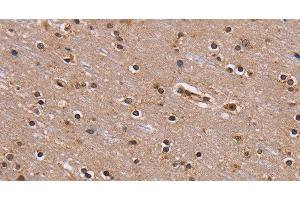 Immunohistochemistry of paraffin-embedded Human brain using GNL3 Polyclonal Antibody at dilution of 1:60 (Nucleostemin Antikörper)