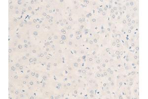 Immunohistochemistry (IHC) image for anti-Myc Proto-Oncogene protein (MYC) (pThr58) antibody (ABIN6256584)